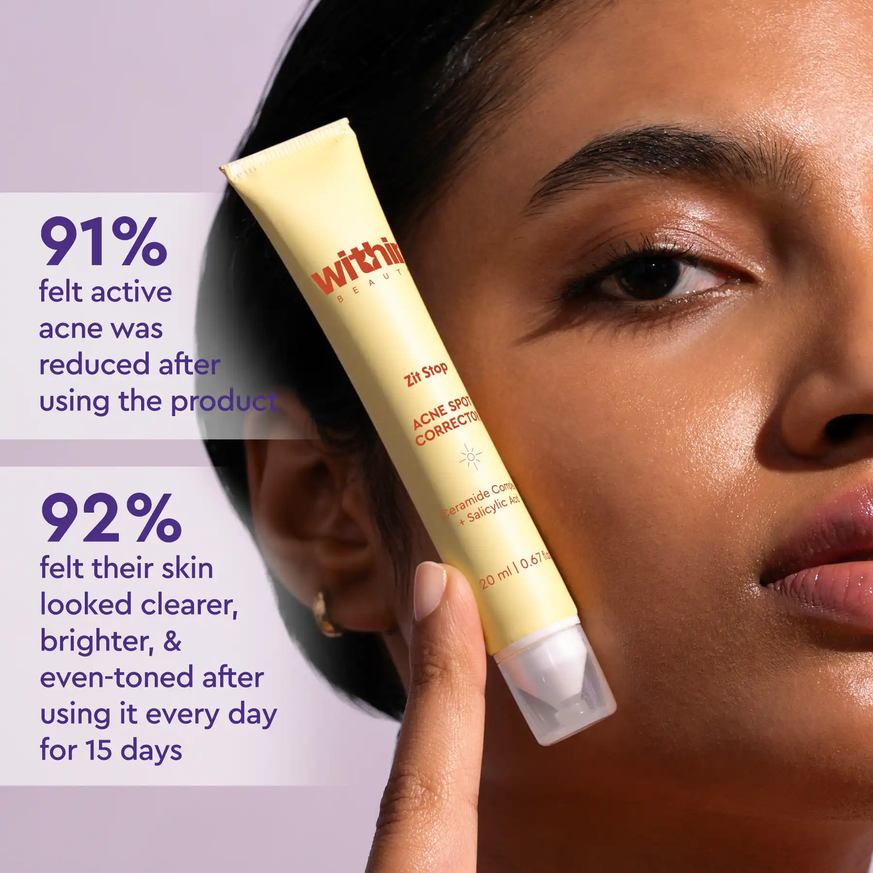 Zit Stop Acne Spot Corrector 20ml - Image 3